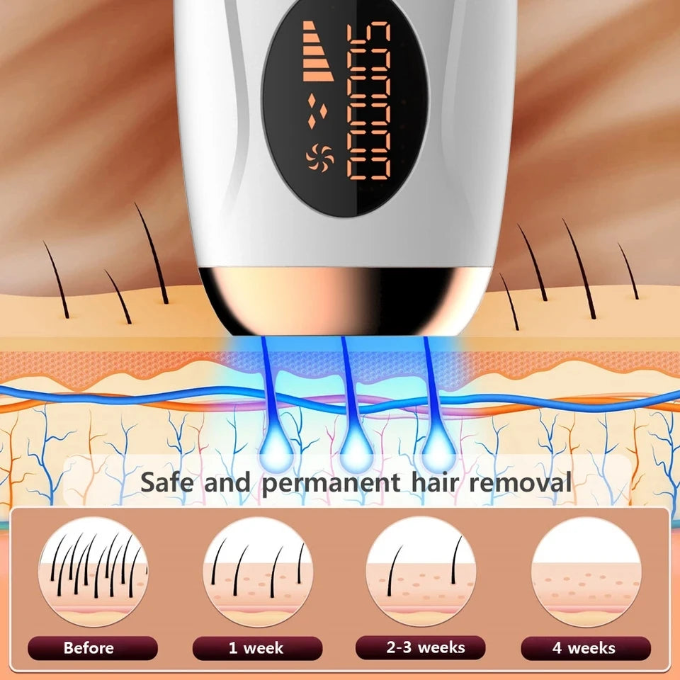 IPL Laser Hair Removal Epilator – 999,999 Flashes