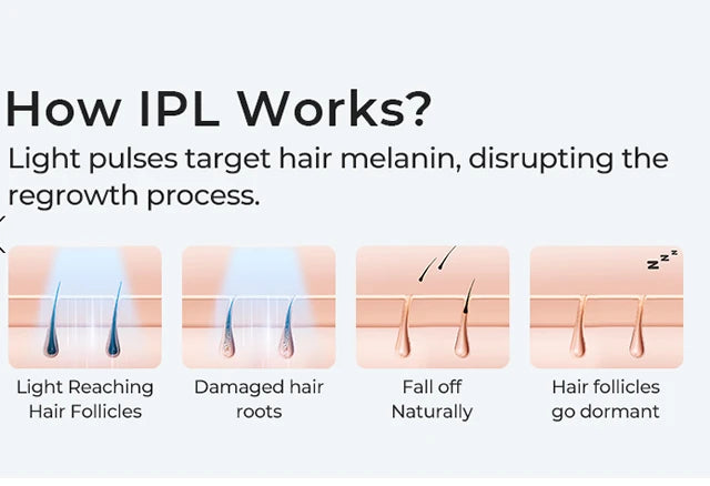 Laser Hair Removal Device IPL